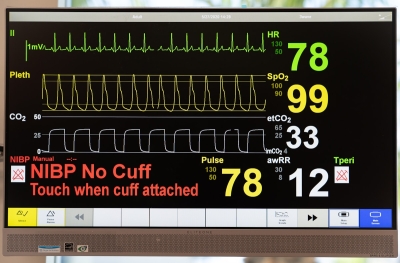 Op de Harvard-spoed had AI vaker gelijk dan de dokter
